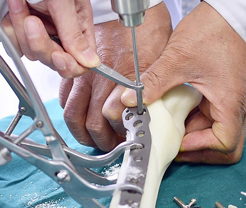 3D打印技術在骨科的實際應用有哪些？(圖2)