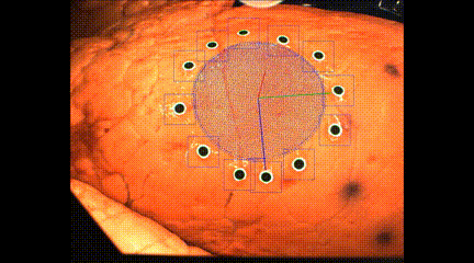 3D打印新成果!新技術或將助力診斷監測新冠肺炎(圖2) 3D打印新成果!新技術或將助力診斷監測新冠肺炎(圖2)
